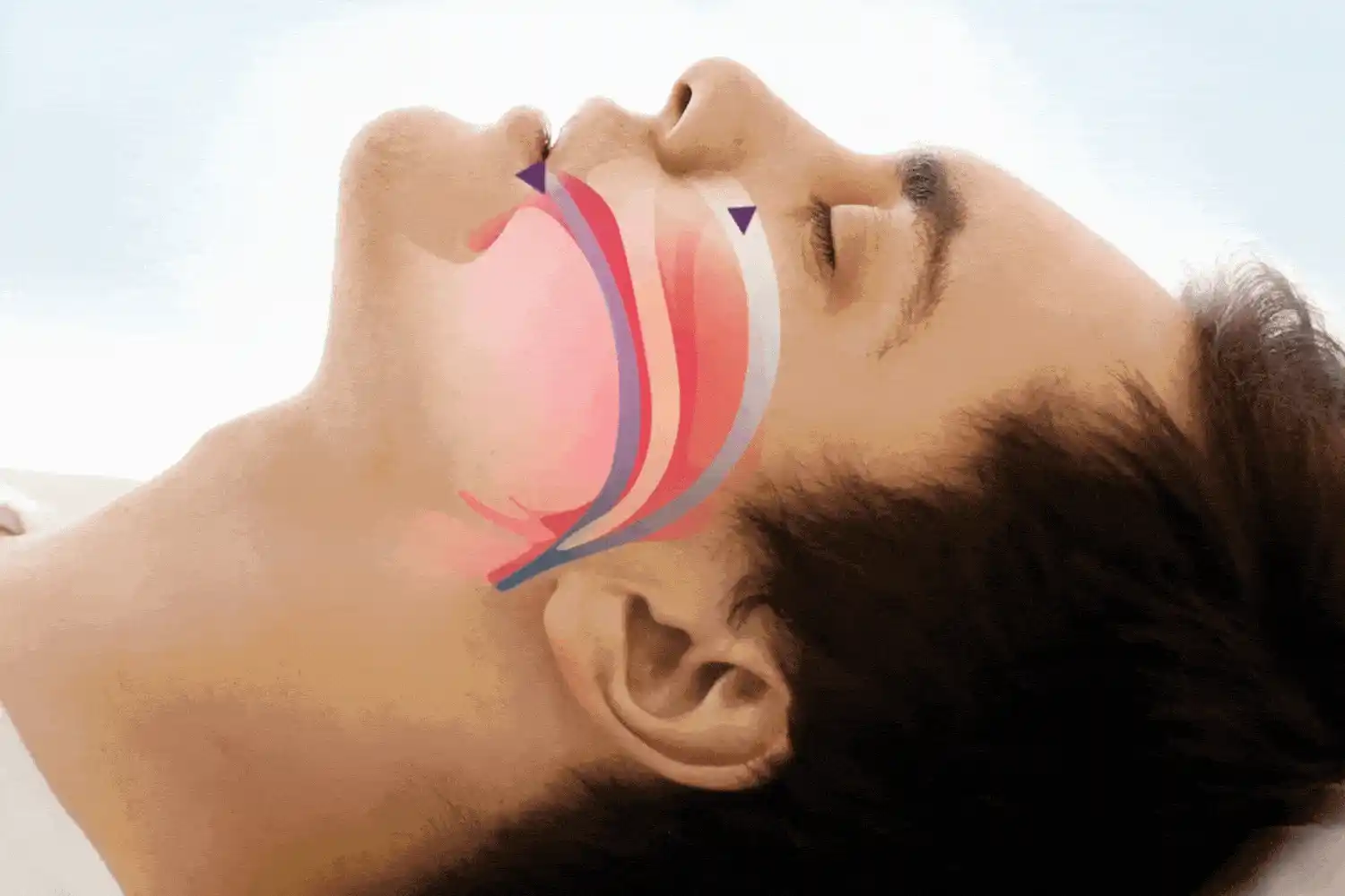 Snoring solution device in action