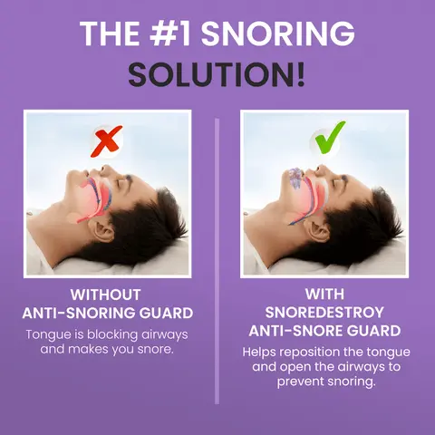 Snoring solution device mechanism