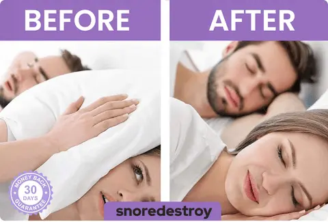 Snoring solution device